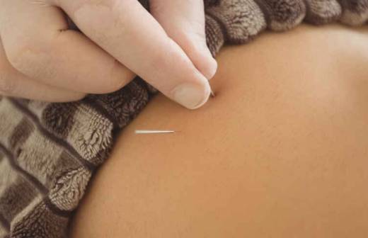 Acupuntura
