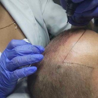 Micropigmentação e estética - Depilação - Lousada