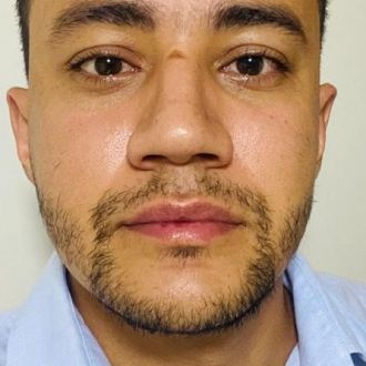 Osmar Júnior - Desarrollador de software para móviles - Alfragide